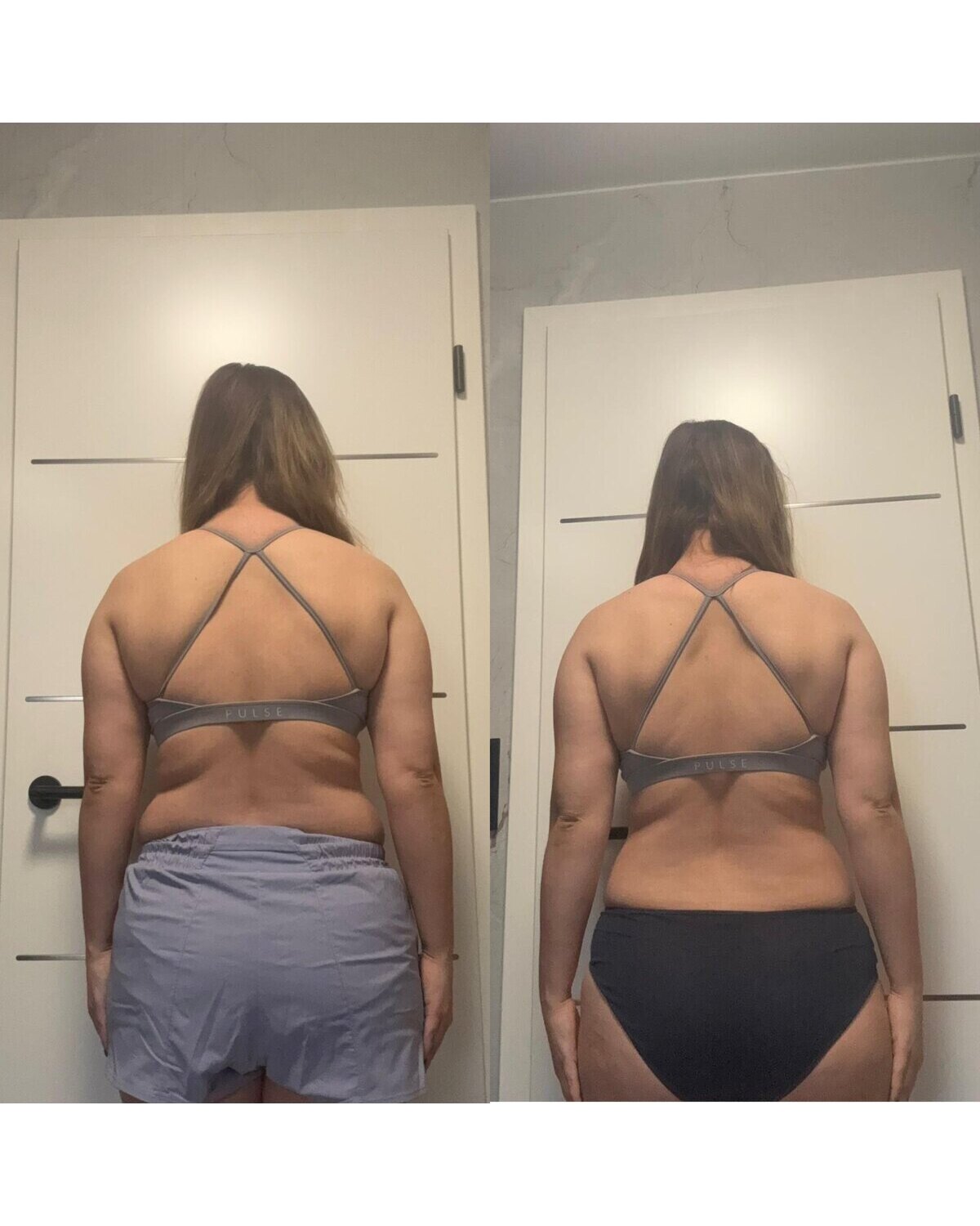 Back and shoulder progress