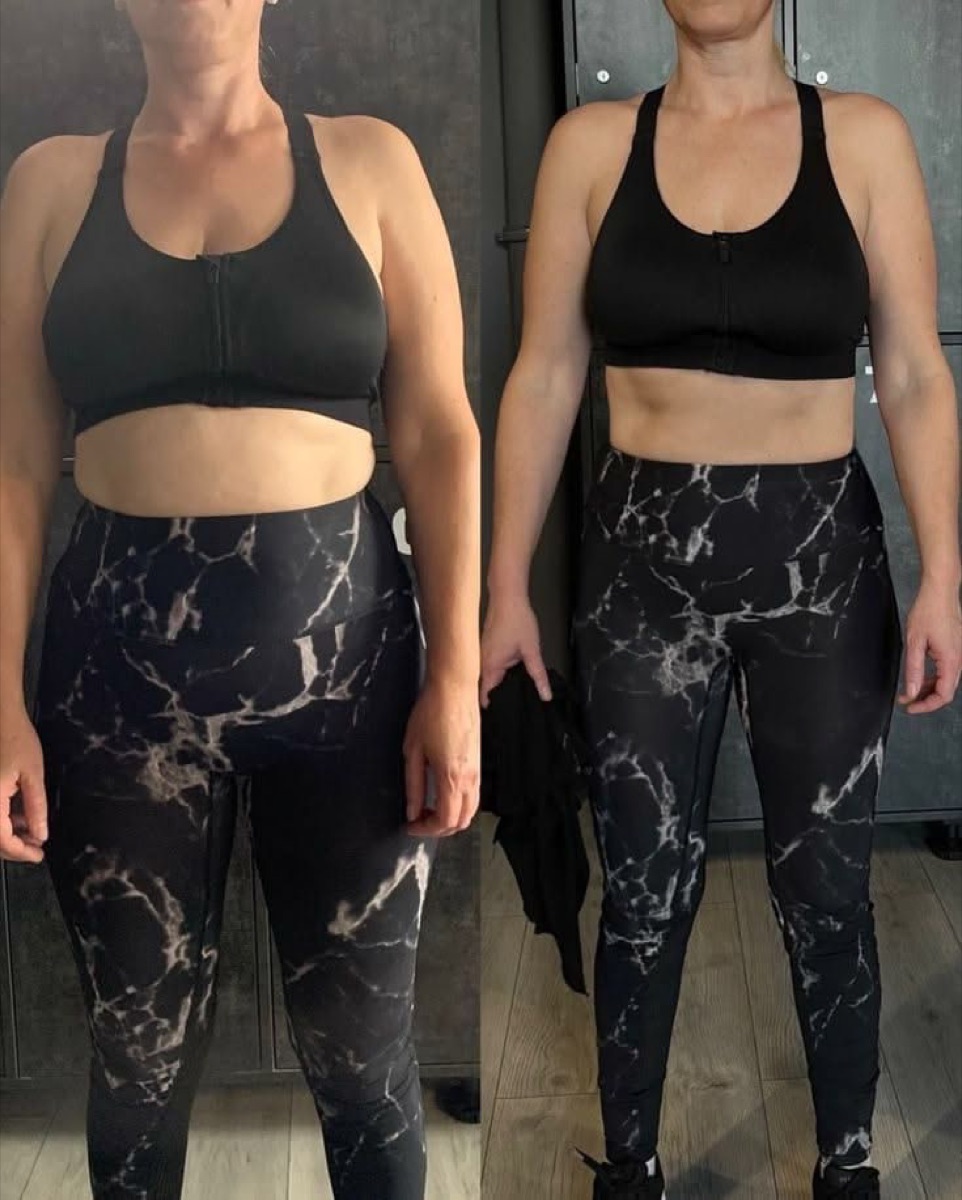Client before and after, front view