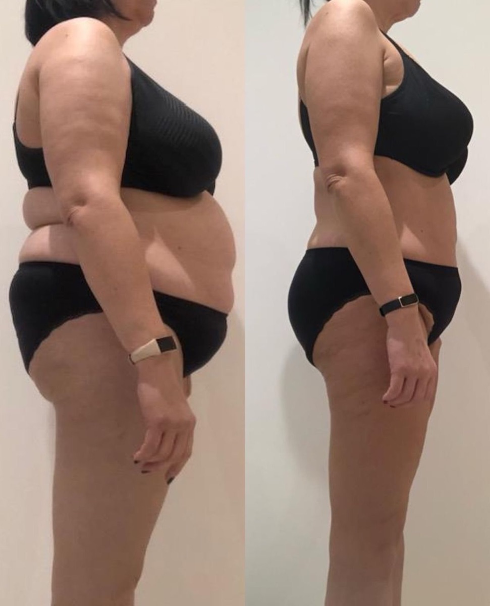 Client side before and after